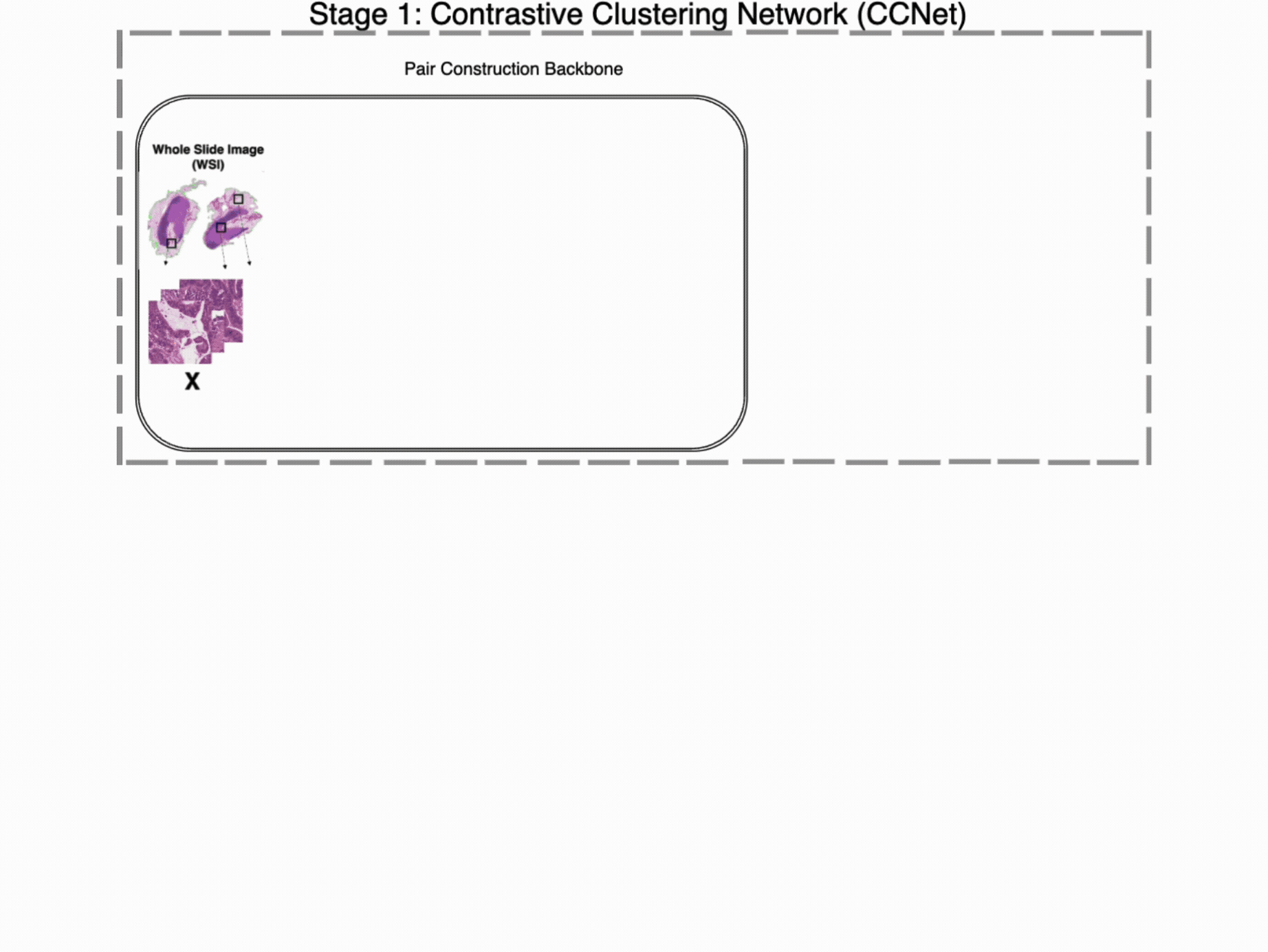 Contrastive Pre-Training & MIL for MSI